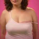 Octubre rosa: Este lunes lanzan el proyecto “Cicatrices que Salvan Vidas”